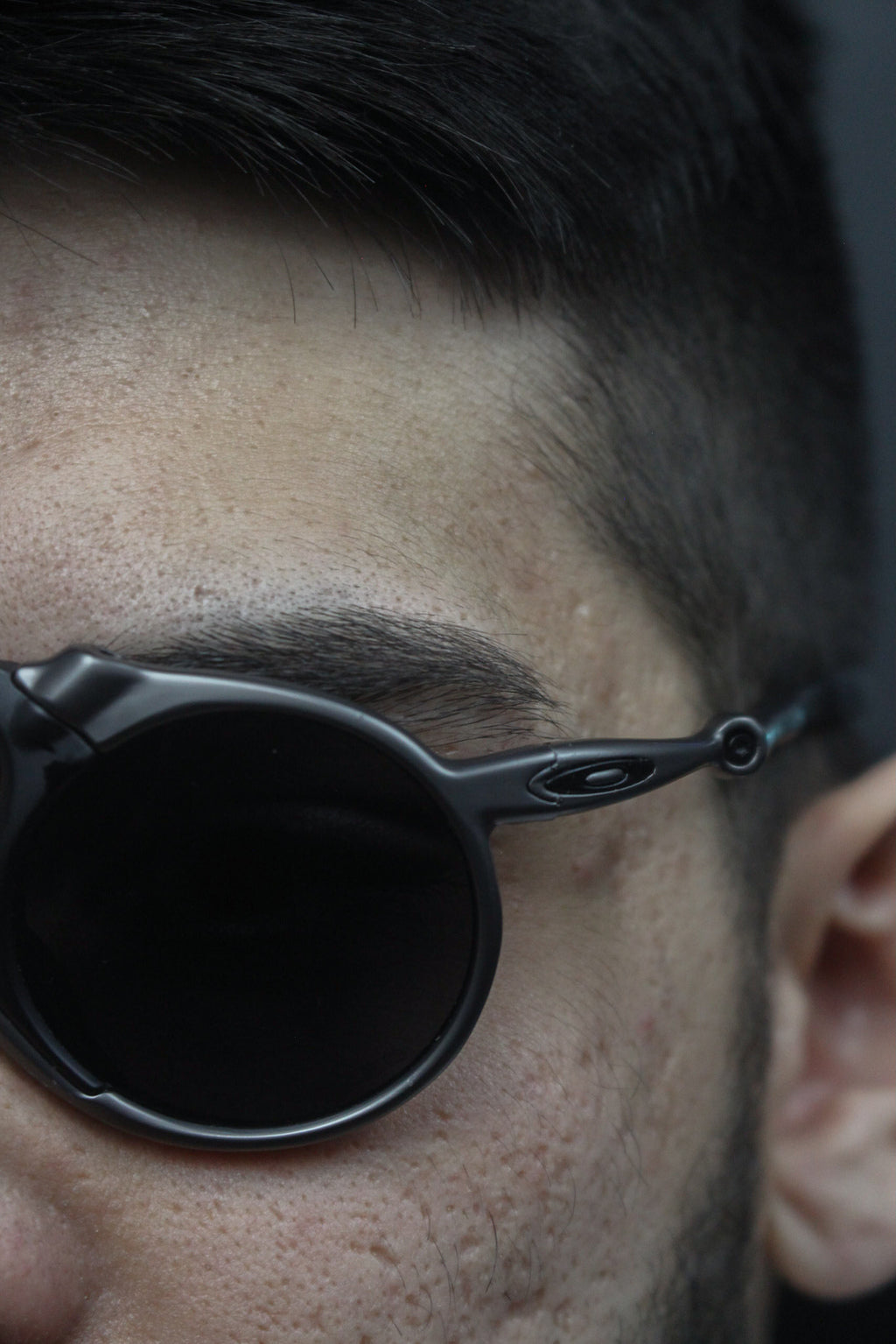 Madman nas Black (2x1)